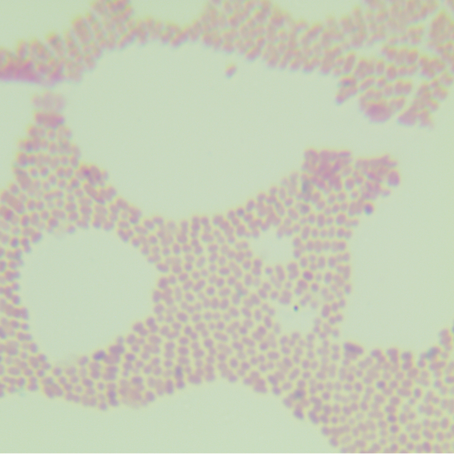 Ferguson Escherichia coli-BNCC