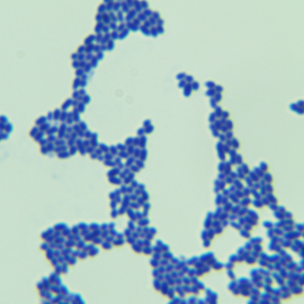 Intestinal membrane bead fungus milk fat subspecies-BNCC
