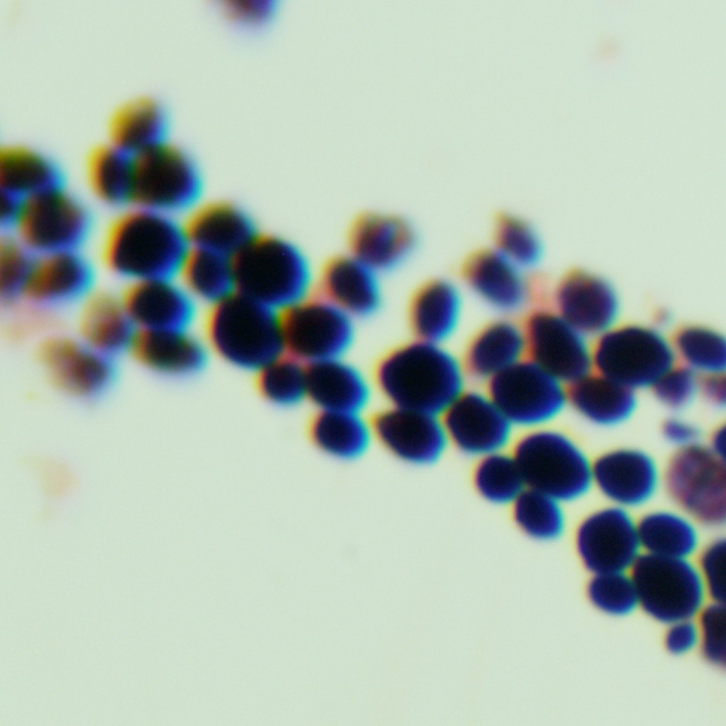 Wickerhamiella versatilis-BNCC