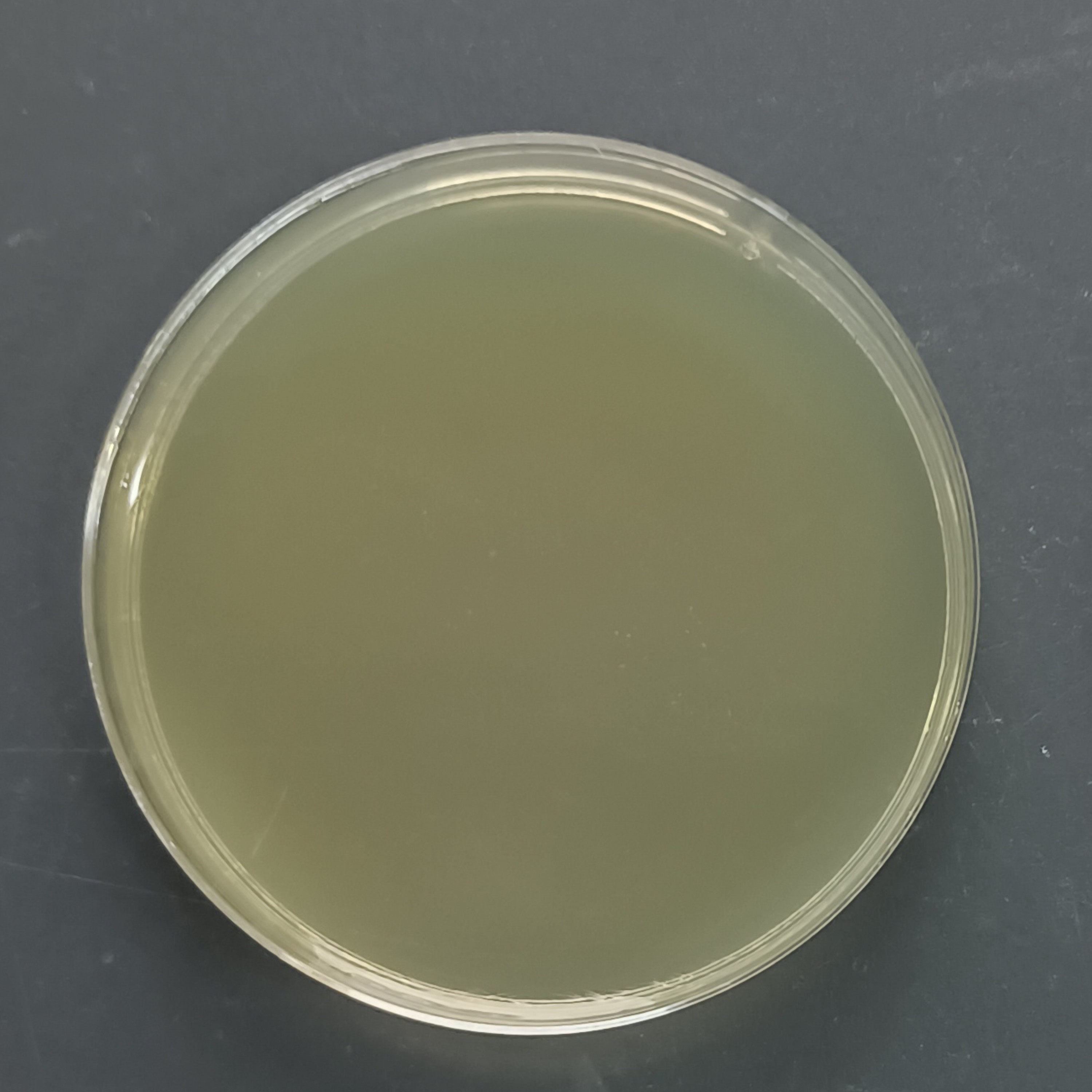 Eastern Issac Yeast Nucleic Acid Reference (Heat-inactivated) (Strong Positive)-BNCC