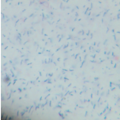 Mycobacterium bovis-BNCC