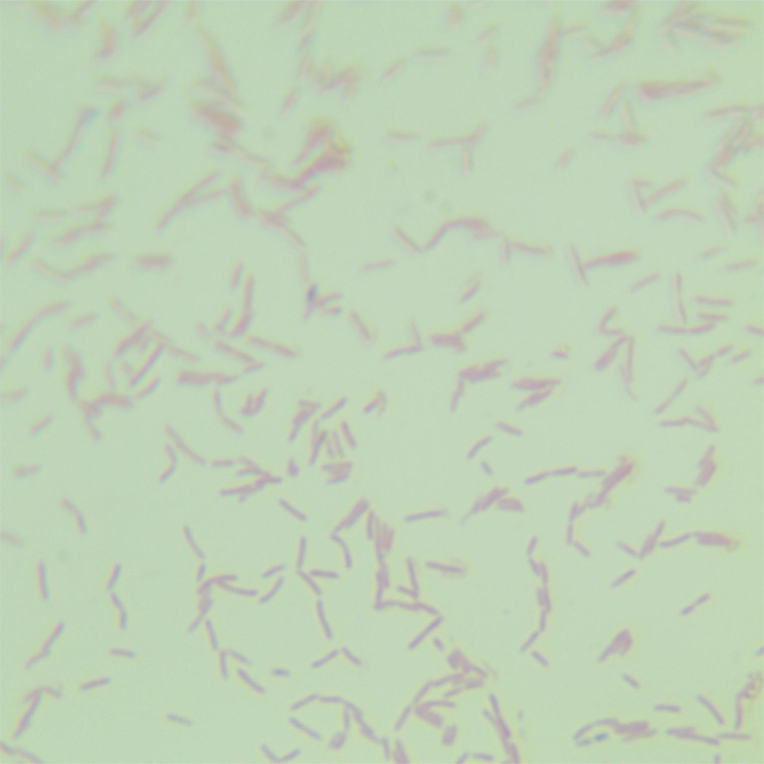 Legionella pneumophila subsp. pneumophila-BNCC