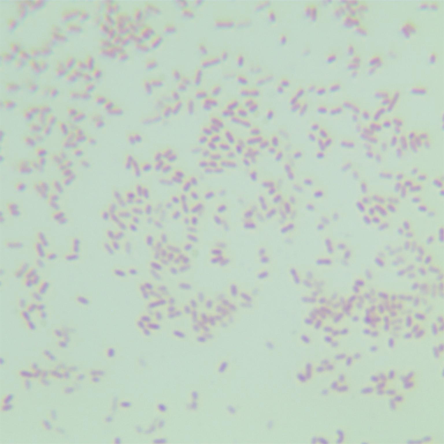 Haemophilus influenzae-BNCC