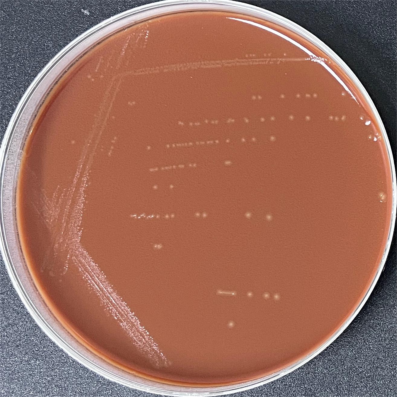 Haemophilus influenzae-BNCC