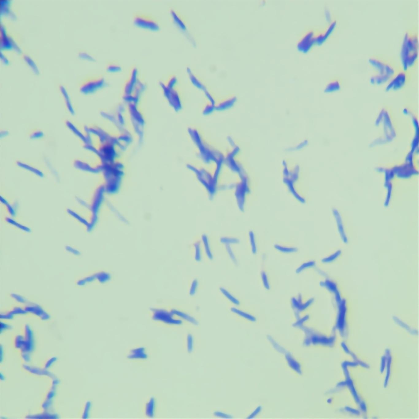 Pseudomonas aeruginosa-BNCC