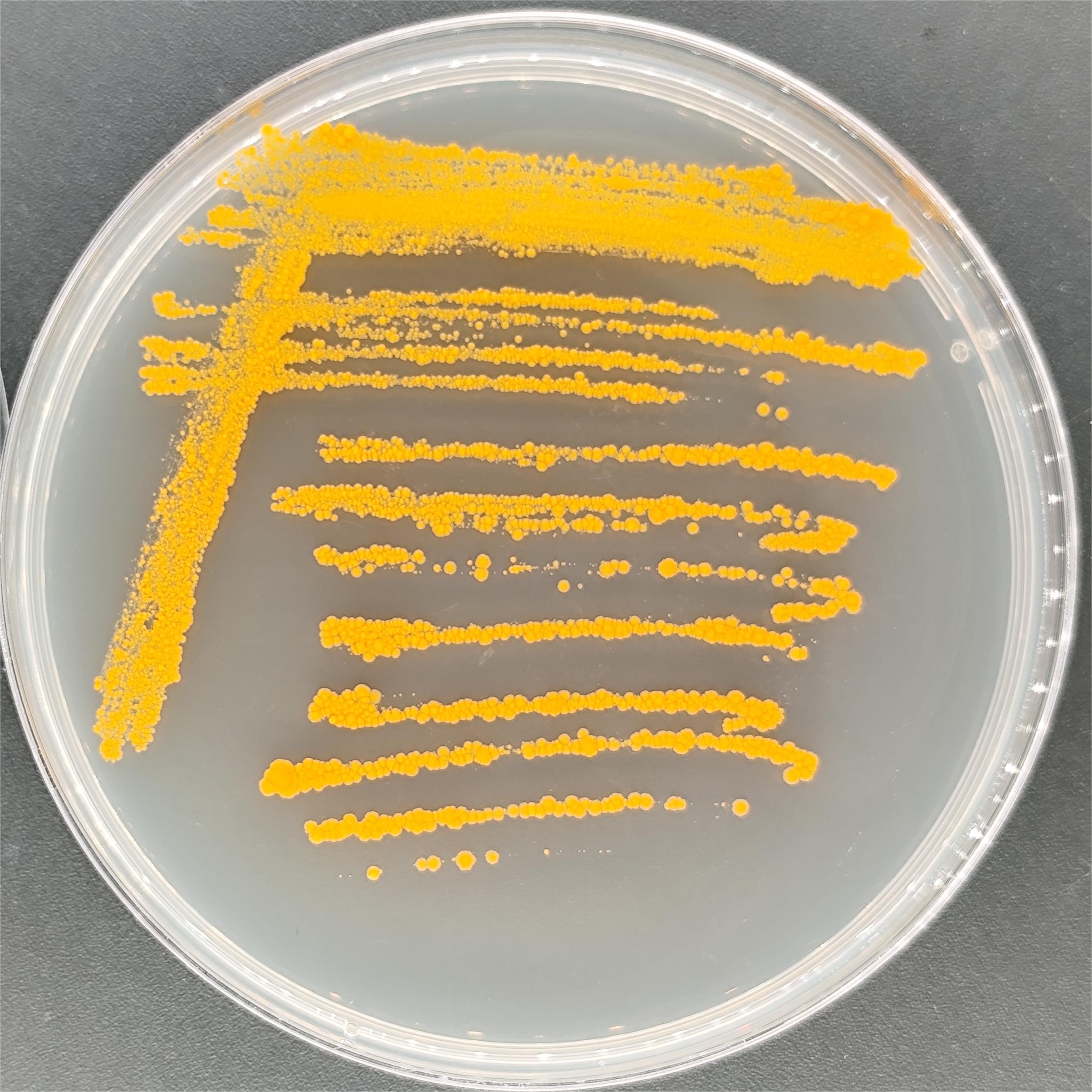 Iranian mycobacteria-BNCC