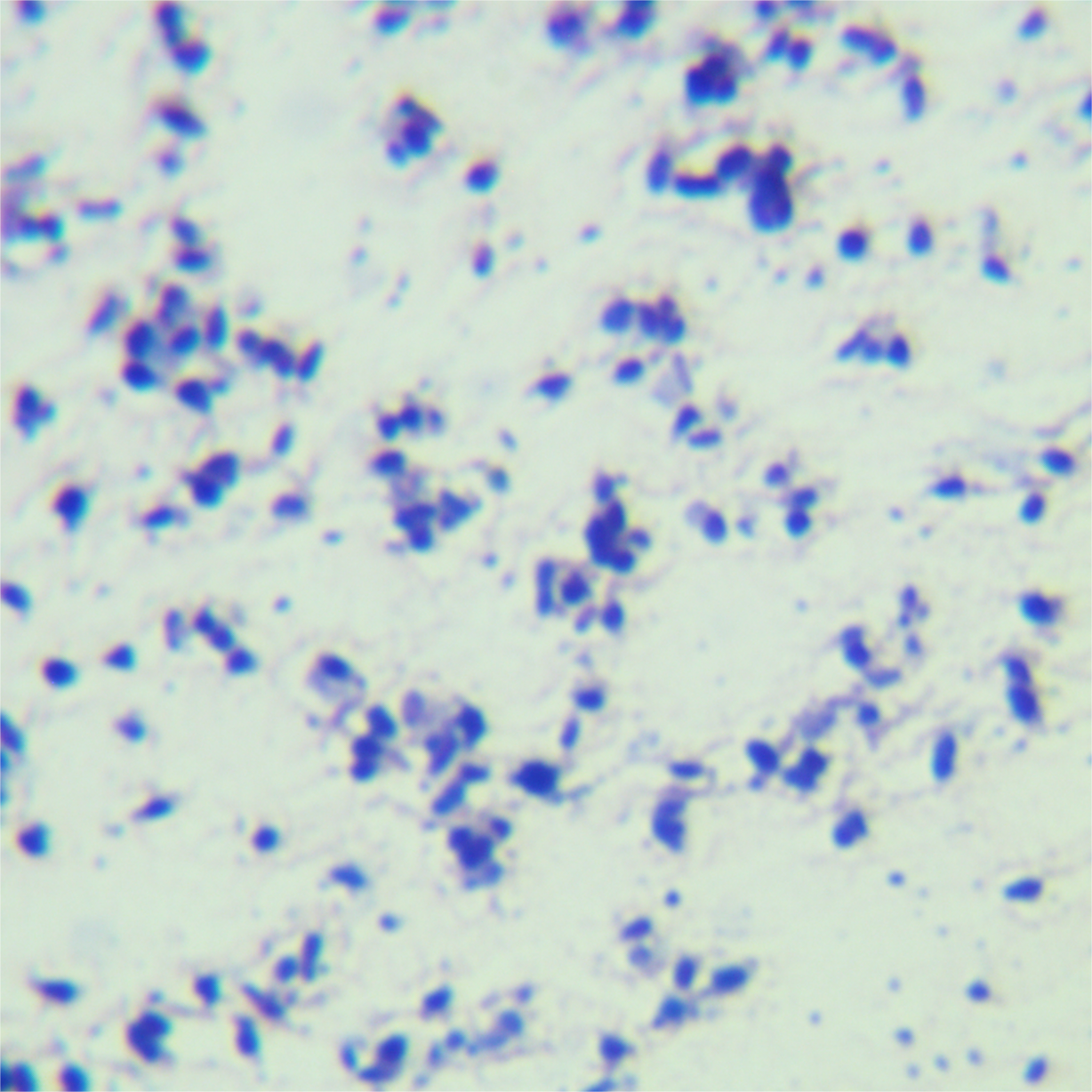 Iranian mycobacteria-BNCC