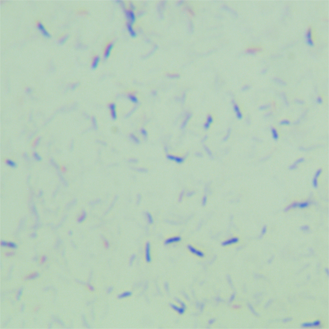 Wound mycobacteria-BNCC