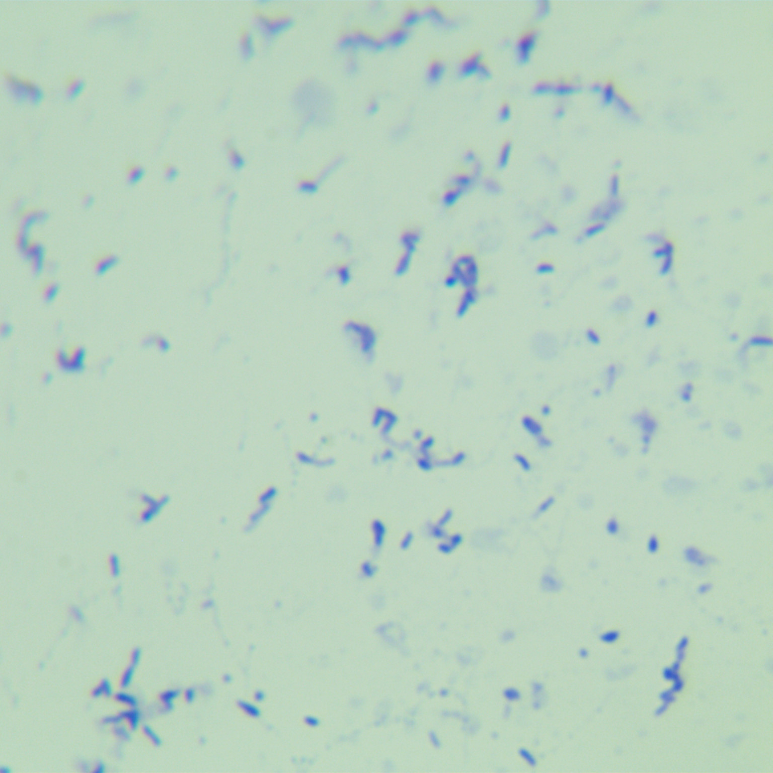 Lombard mycobacteria-BNCC