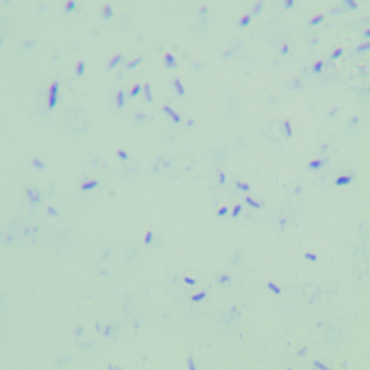 Riyadh mycobacteria-BNCC