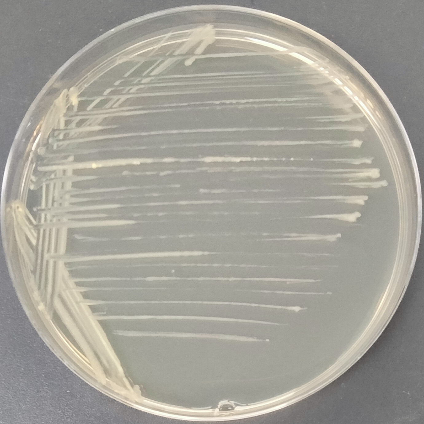 Als mycobacteria-BNCC