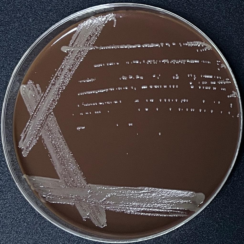 Fusarium mycobacteria-BNCC