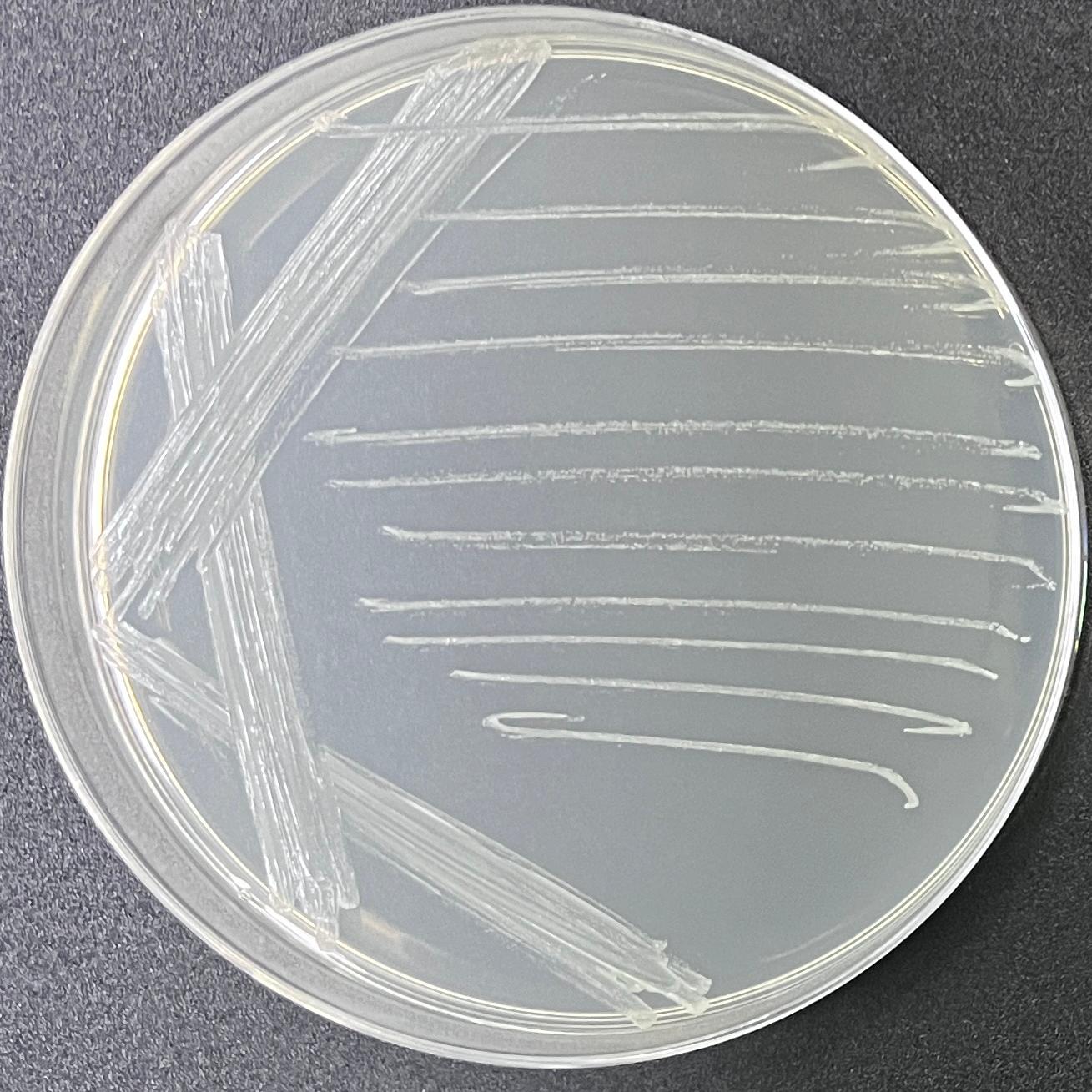 Pregnant Mycobacterium-BNCC
