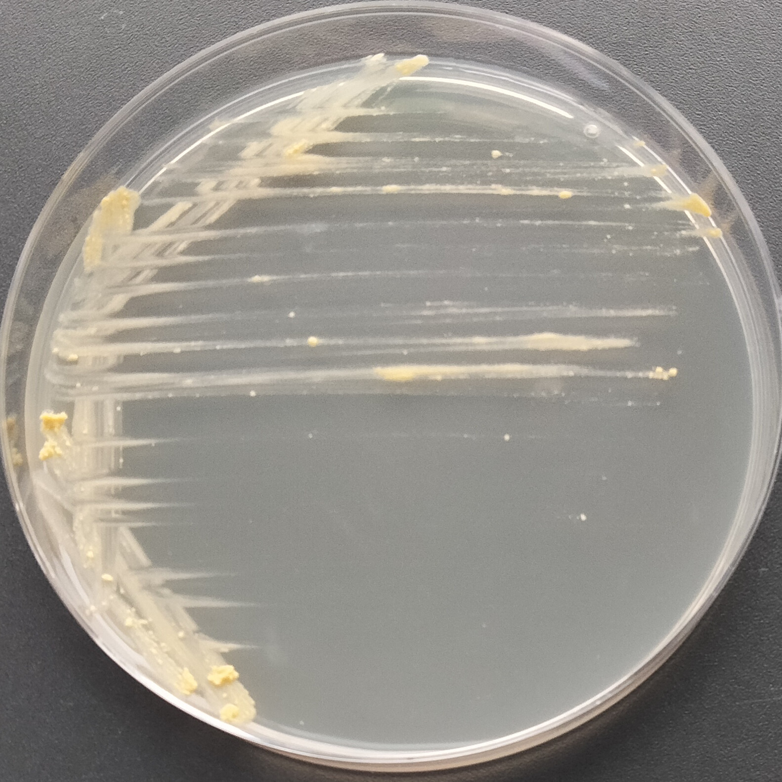 Ankona mycobacteria-BNCC