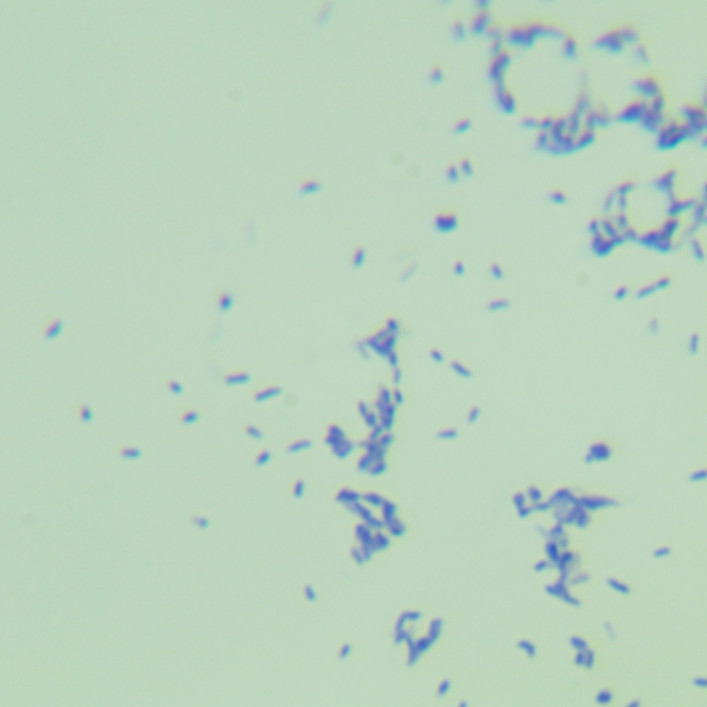 Secondary mycobacteria-BNCC