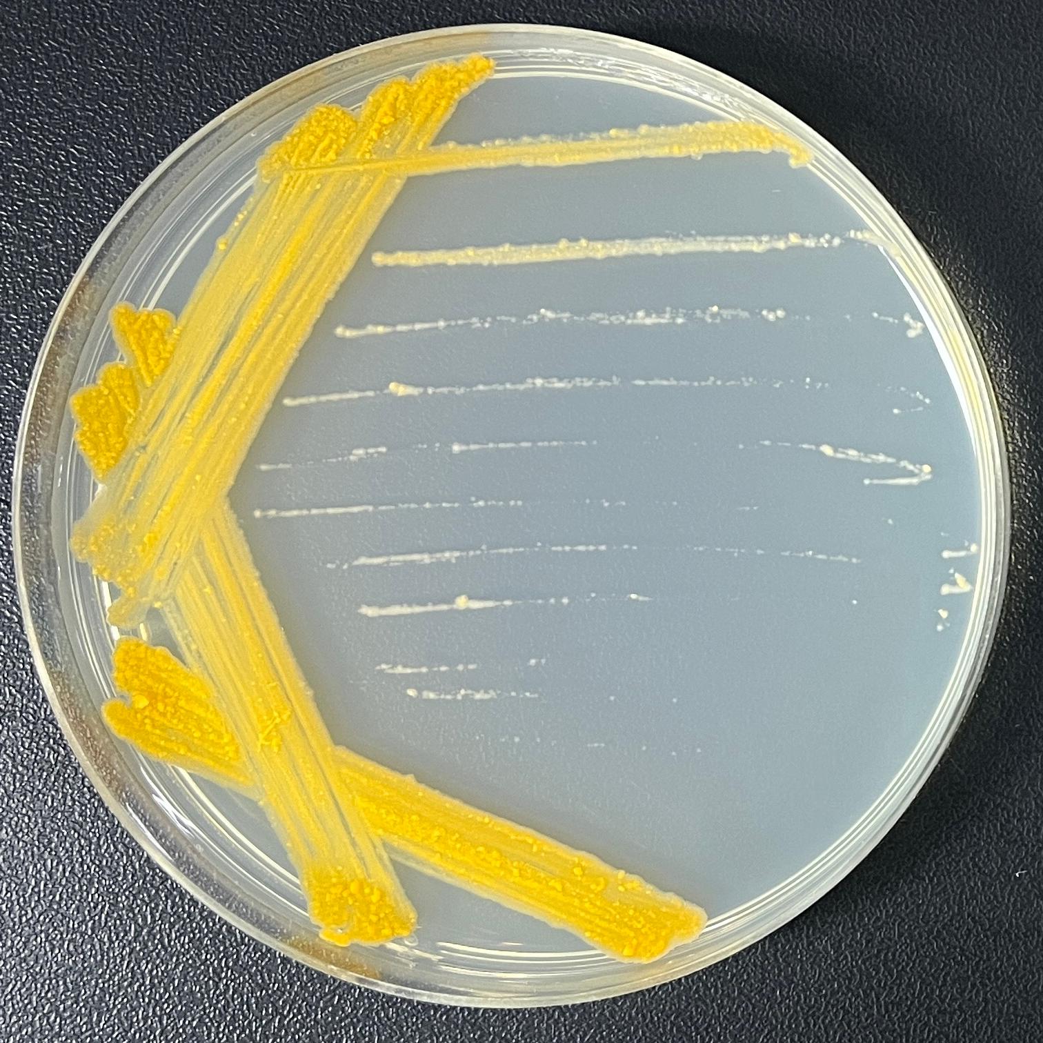 Mycobacterium huo-BNCC