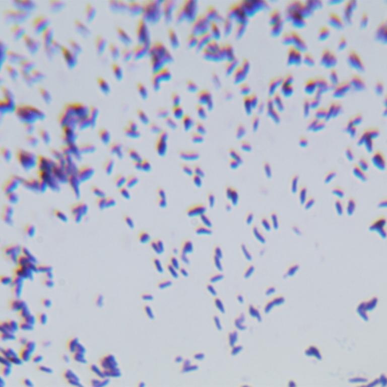 Mycobacterium huo-BNCC