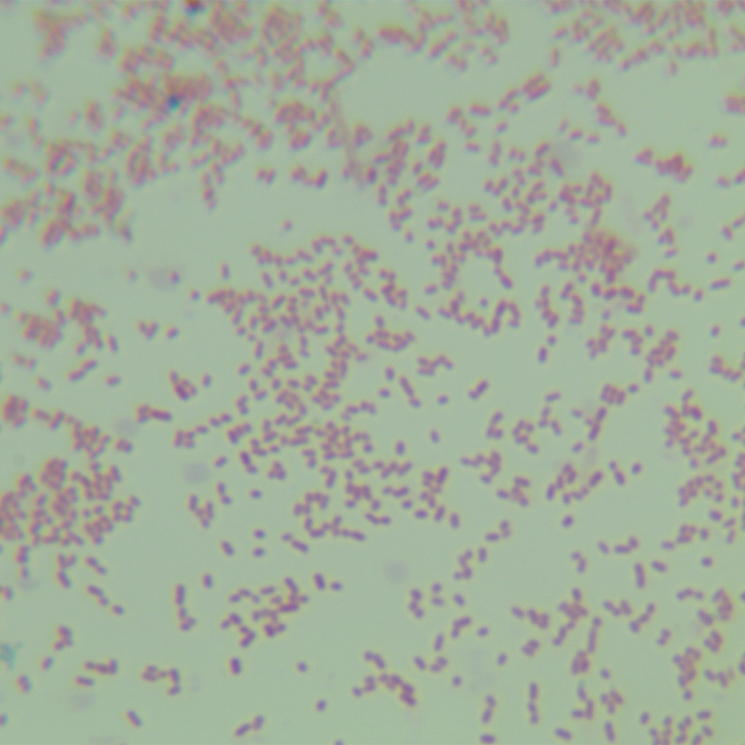 Enterobacter cloacae-BNCC