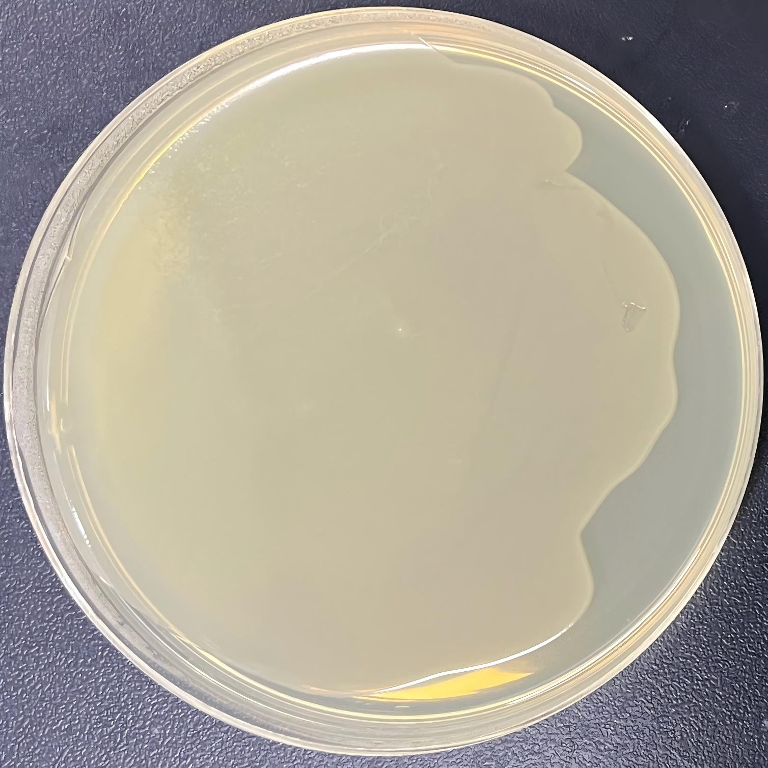 DH5 α (containing pET28a-VP1 (Norovirus GII) plasmid) Escherichia coli-BNCC