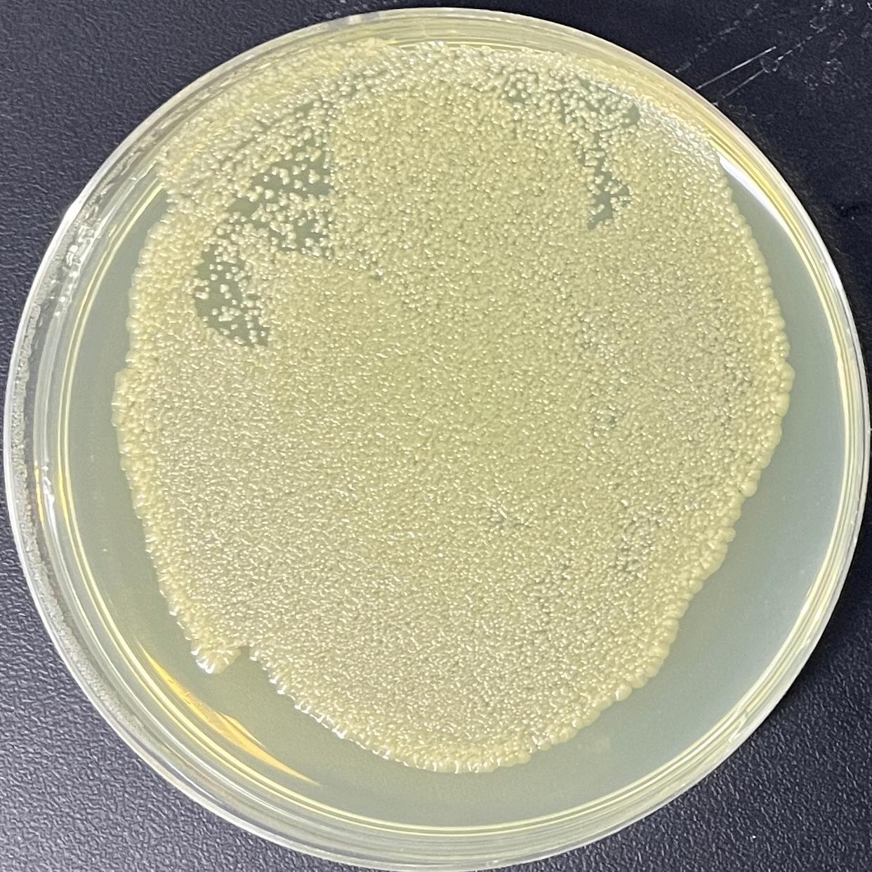 DH5 α (containing PPRE X3-TK-luc plasmid) Escherichia coli-BNCC
