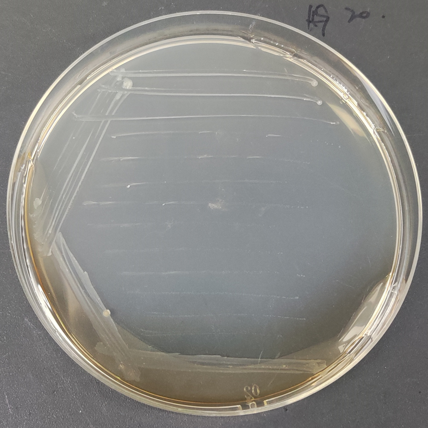 Malmo mycobacteria-BNCC