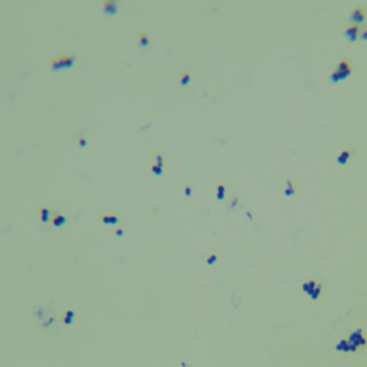 Malmo mycobacteria-BNCC