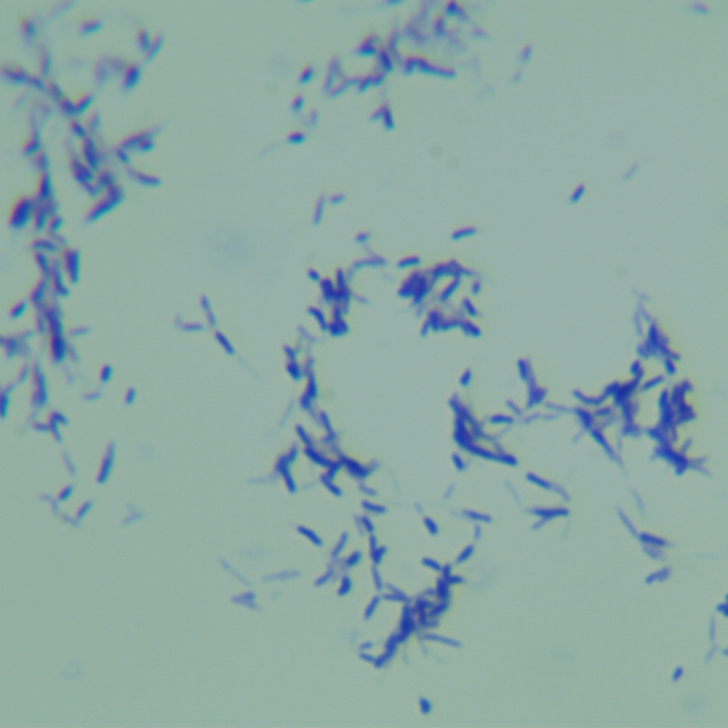 Occasional subspecies of sporadically branched bacteria-BNCC