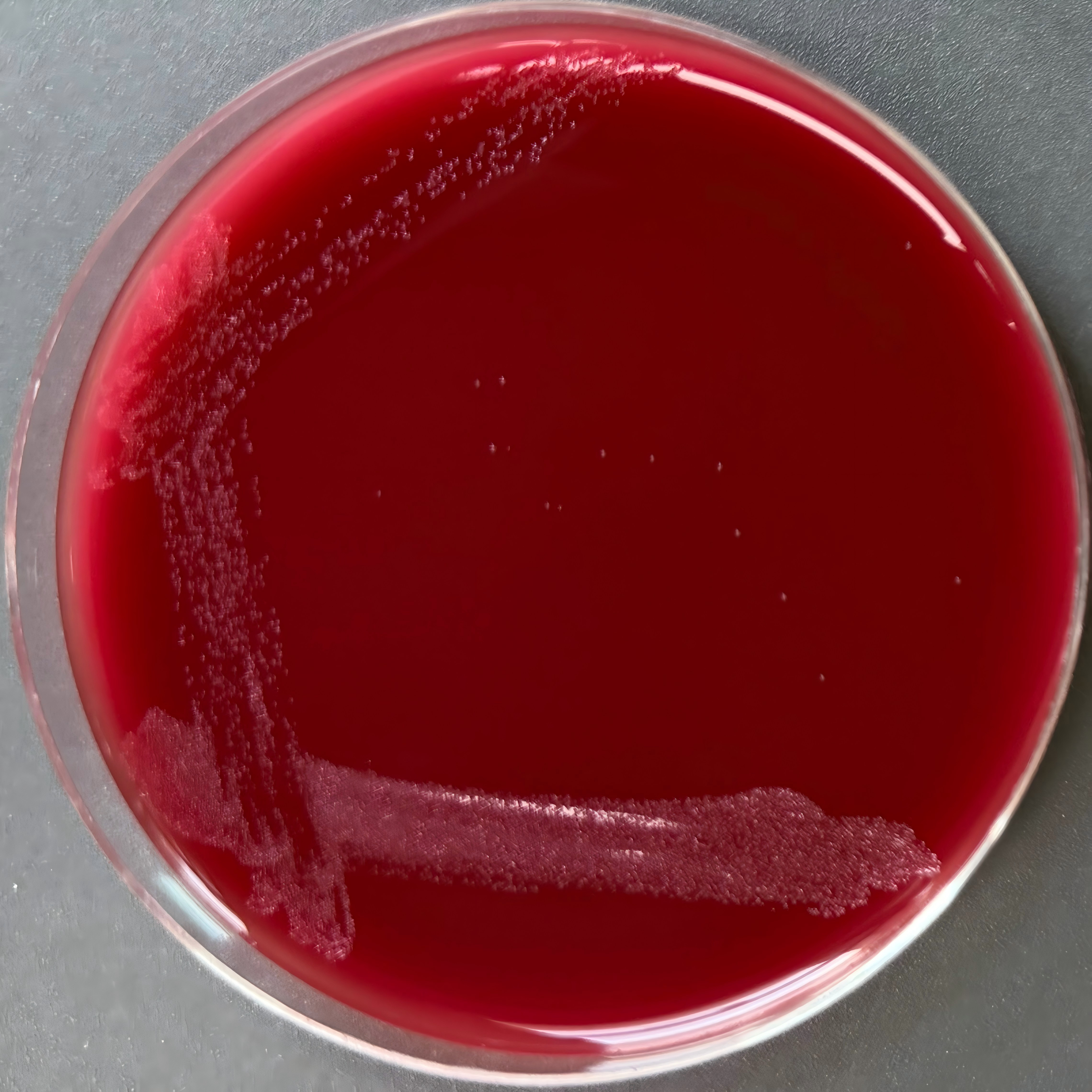 Gordon's bacillus-BNCC