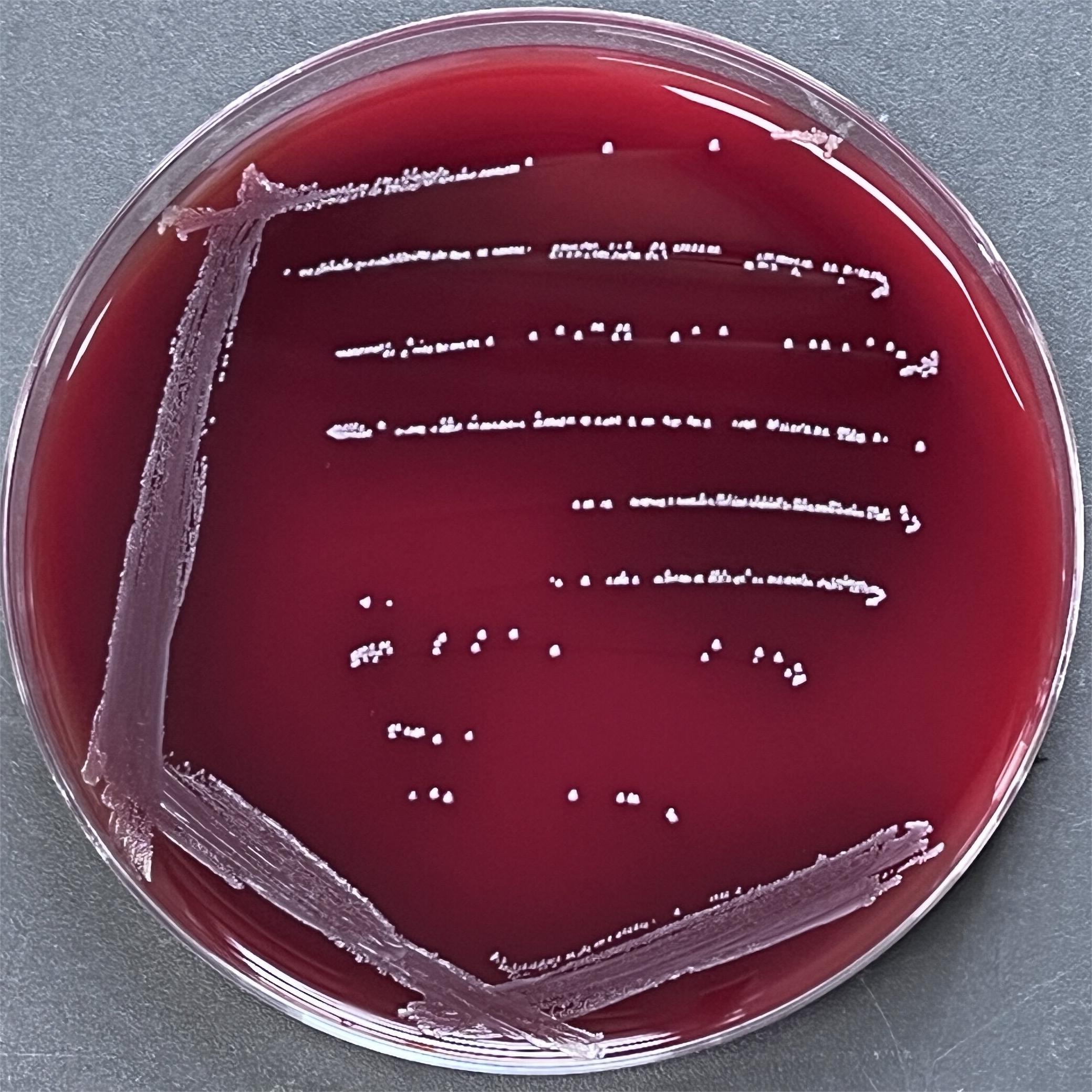 Streptococcus agalactiae-BNCC