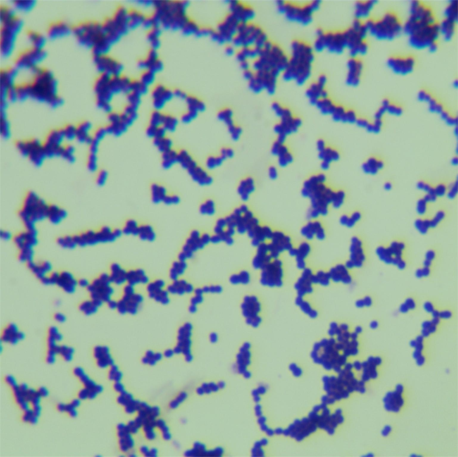 Streptococcus agalactiae-BNCC