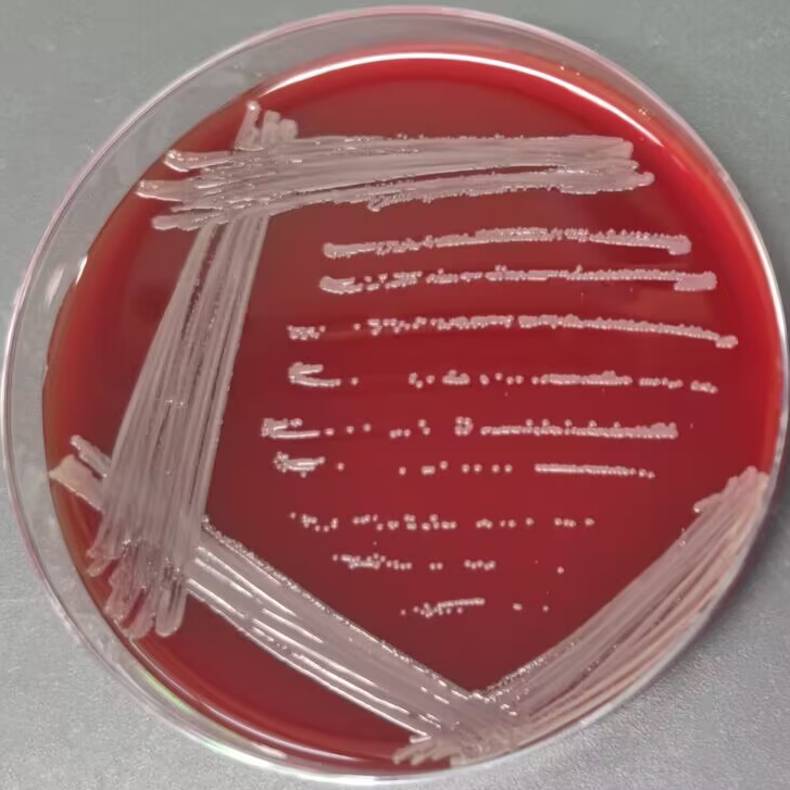 Bordetella bronchialis-BNCC