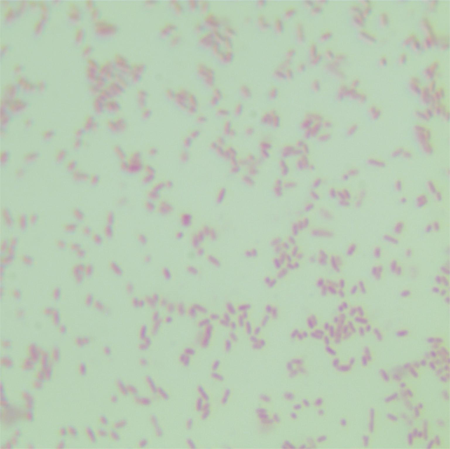 Burkholderia cepacia-BNCC