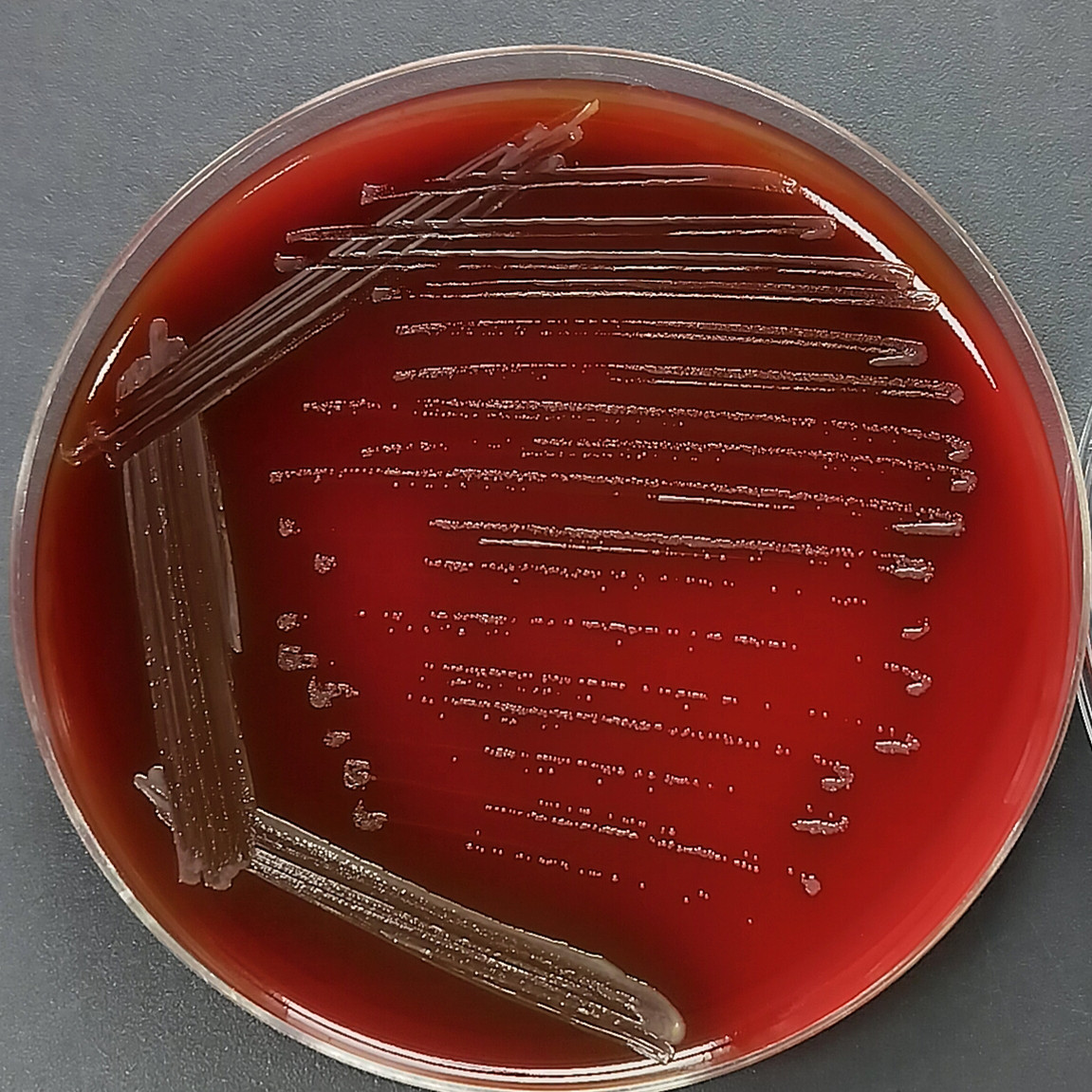 Holmsbordt's bacillus-BNCC