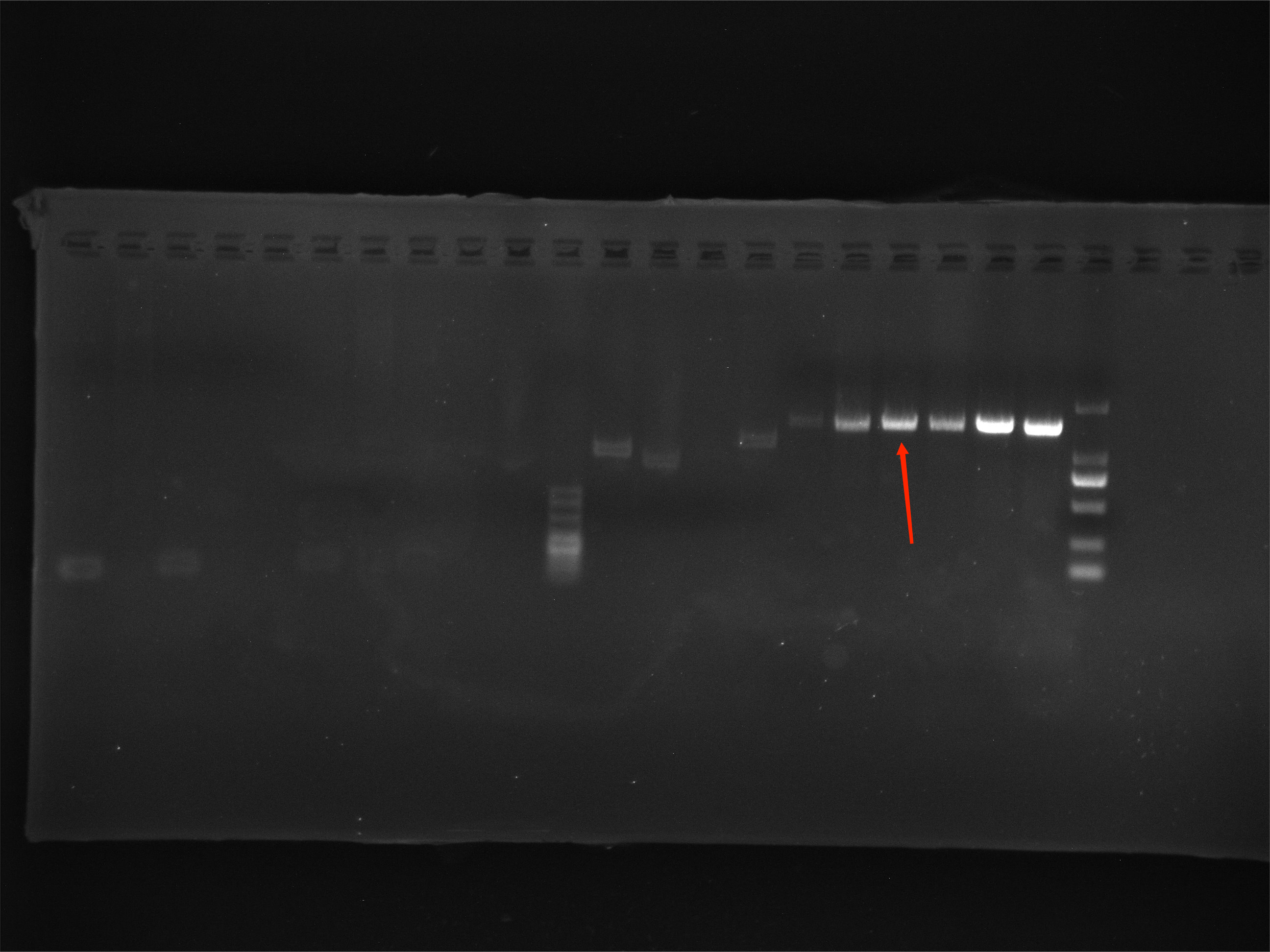 New Golden Mycobacterium Nucleic Acid Reference Material (Thermally Inactivated) (Strongly Positive)-BNCC