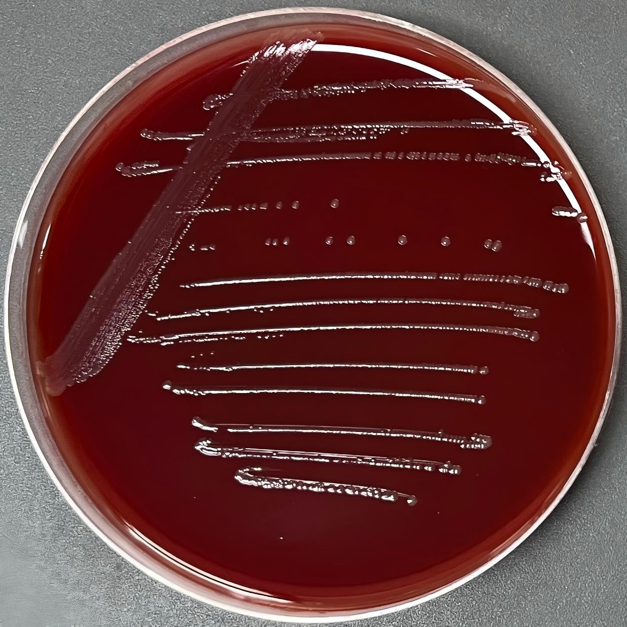 Neisseria gonorrhoeae-BNCC