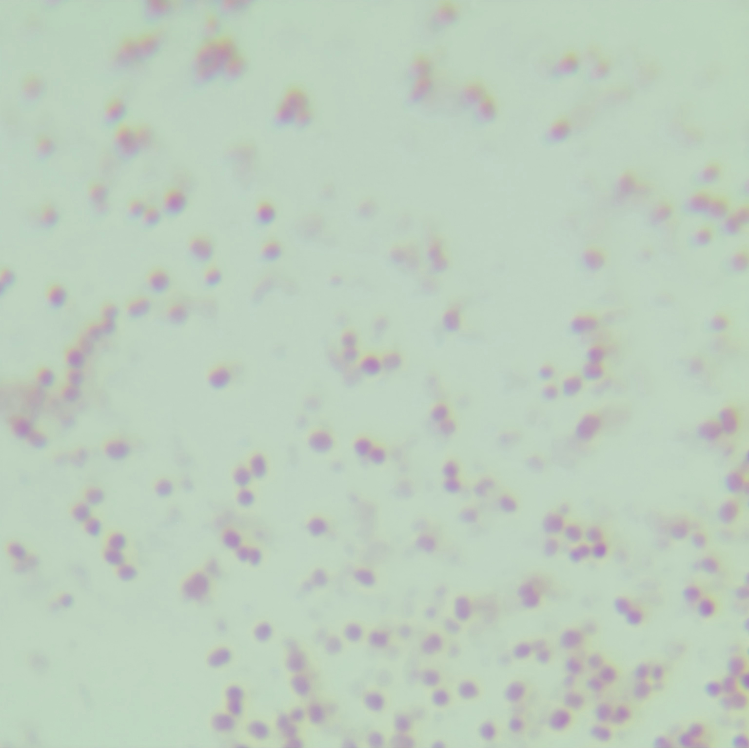 Neisseria gonorrhoeae-BNCC