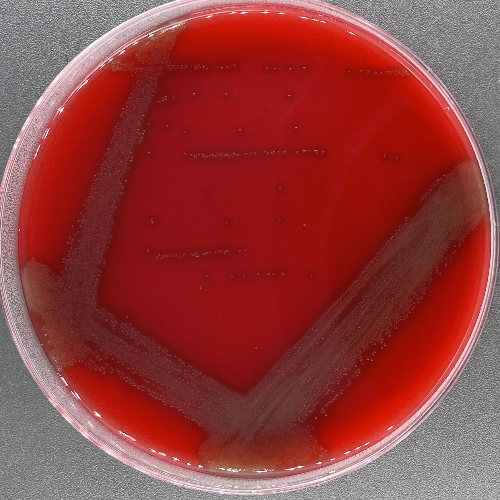 Streptococcus pneumoniae-BNCC