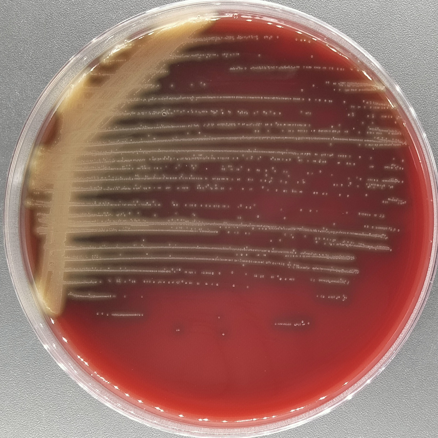 Streptococcus pneumoniae-BNCC