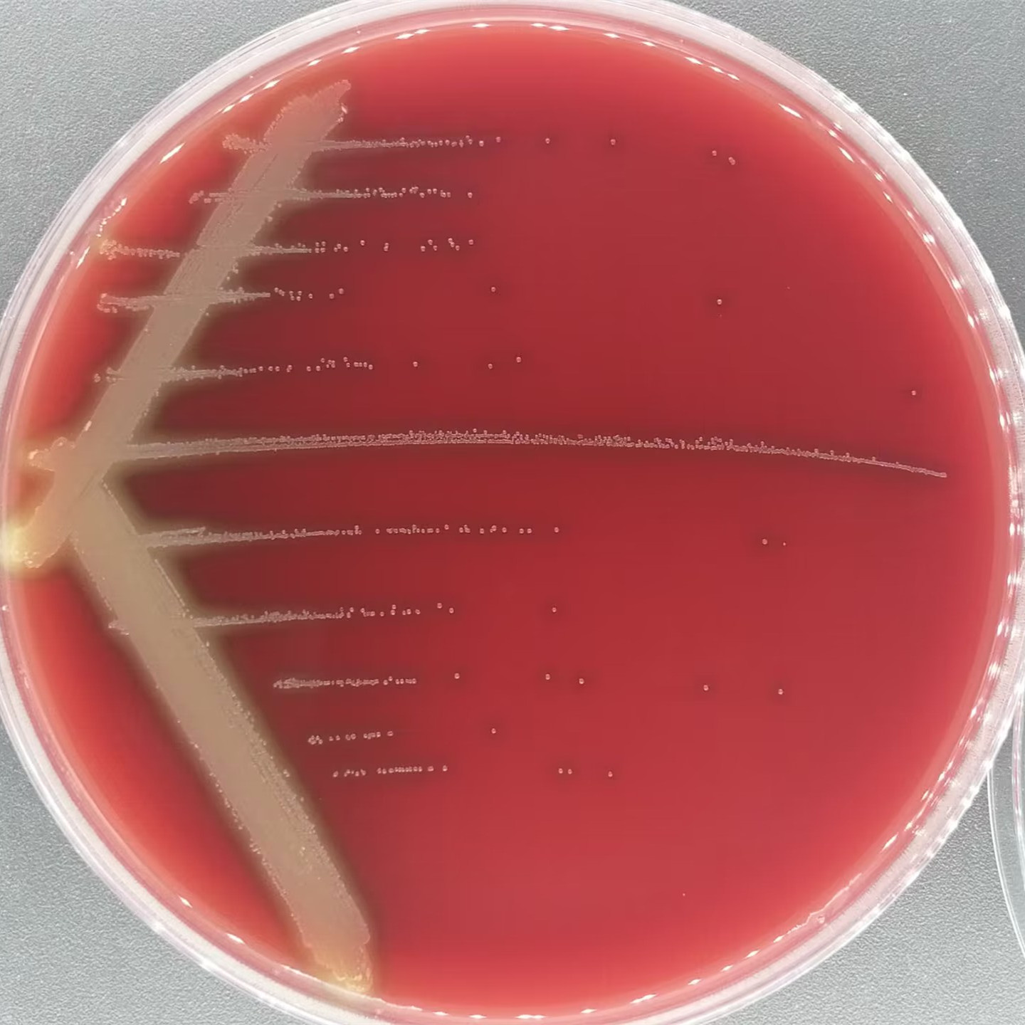 Streptococcus pneumoniae-BNCC