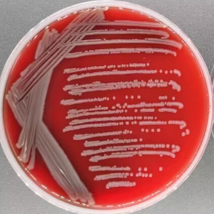 Acinetobacter kanungonis-BNCC