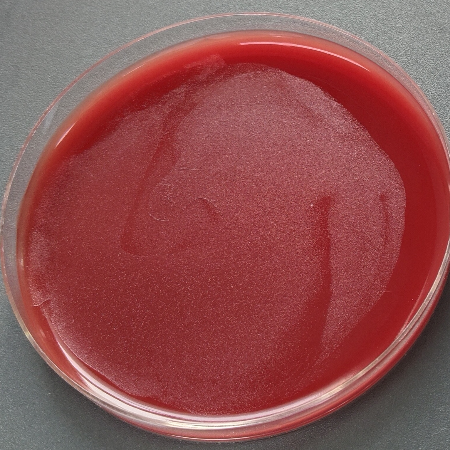 Helicobacter pylori-BNCC