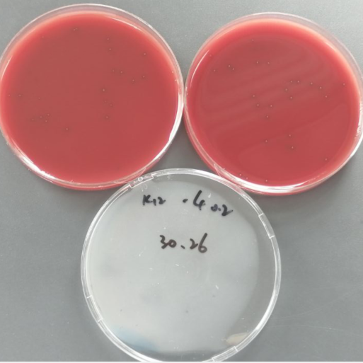 Quantitative strain of Streptococcus pneumoniae-BNCC