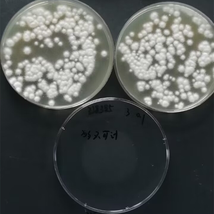 Quantitative strain of Aspergillus fumigatus-BNCC