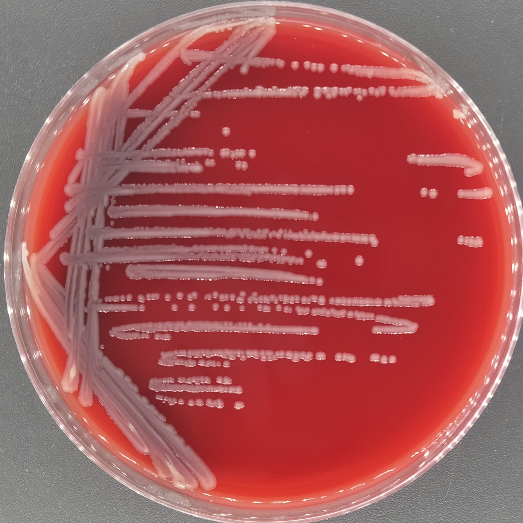 Lactobacillus rhamnosus-BNCC