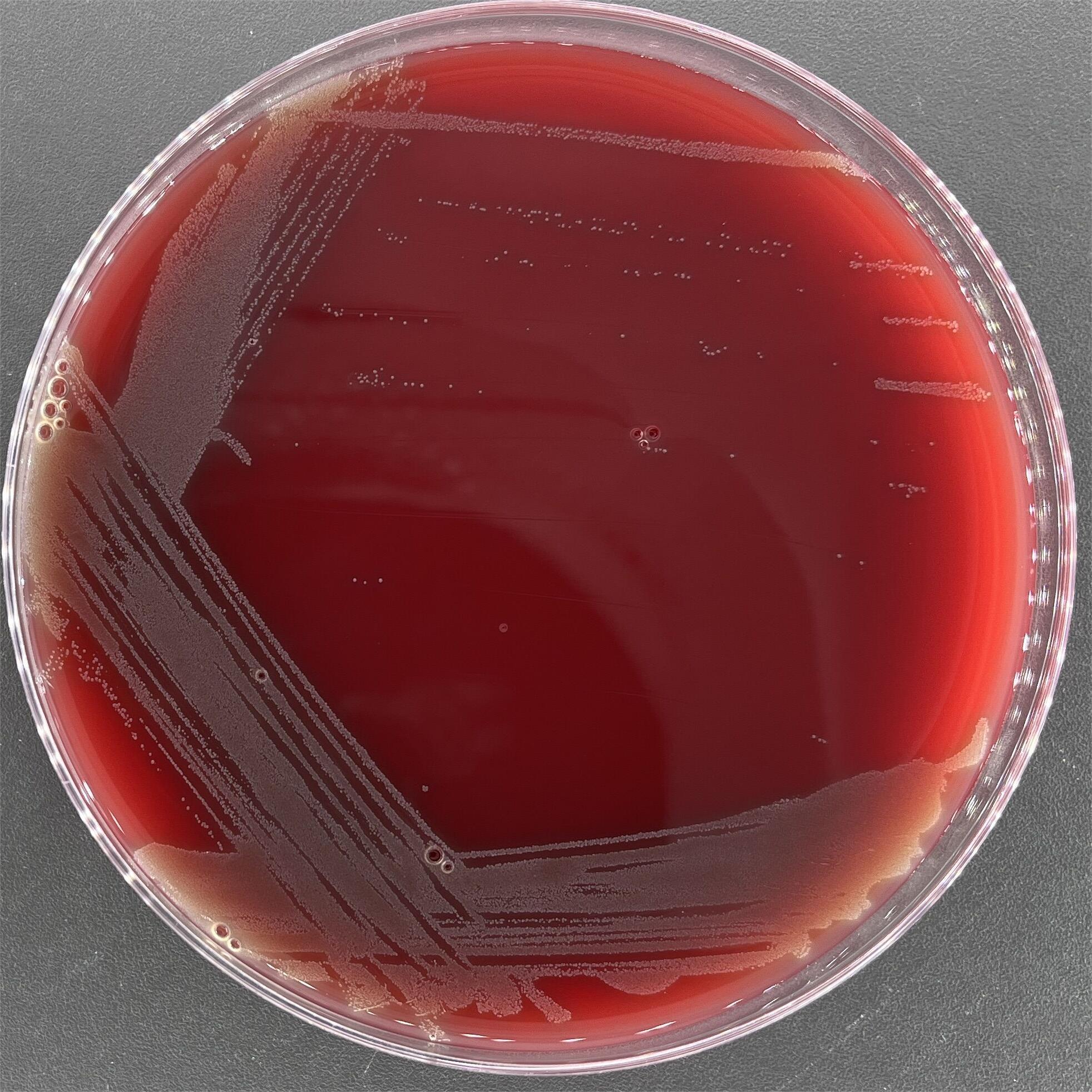 Streptococcus pyogenes-BNCC
