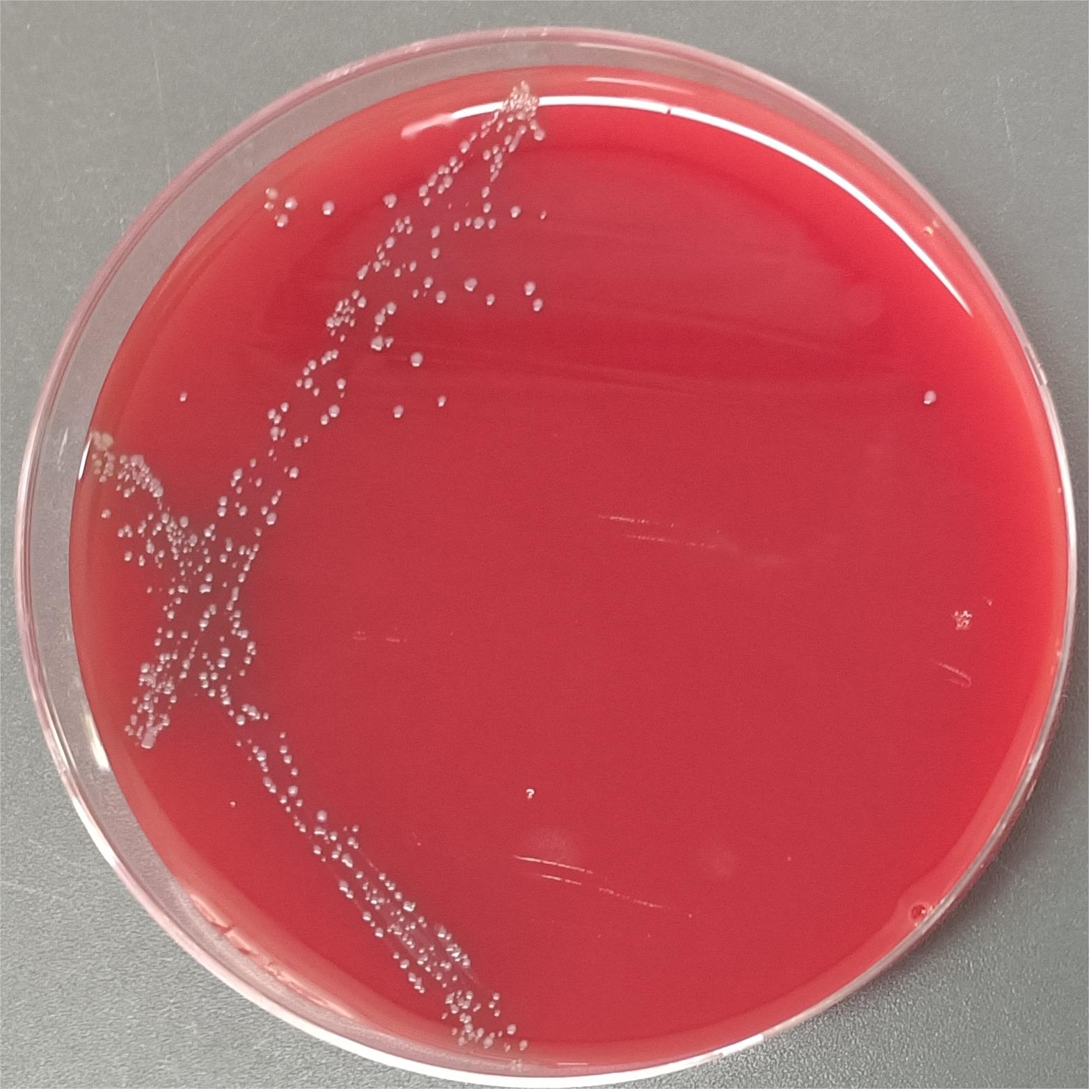 Streptococcus pyogenes-BNCC