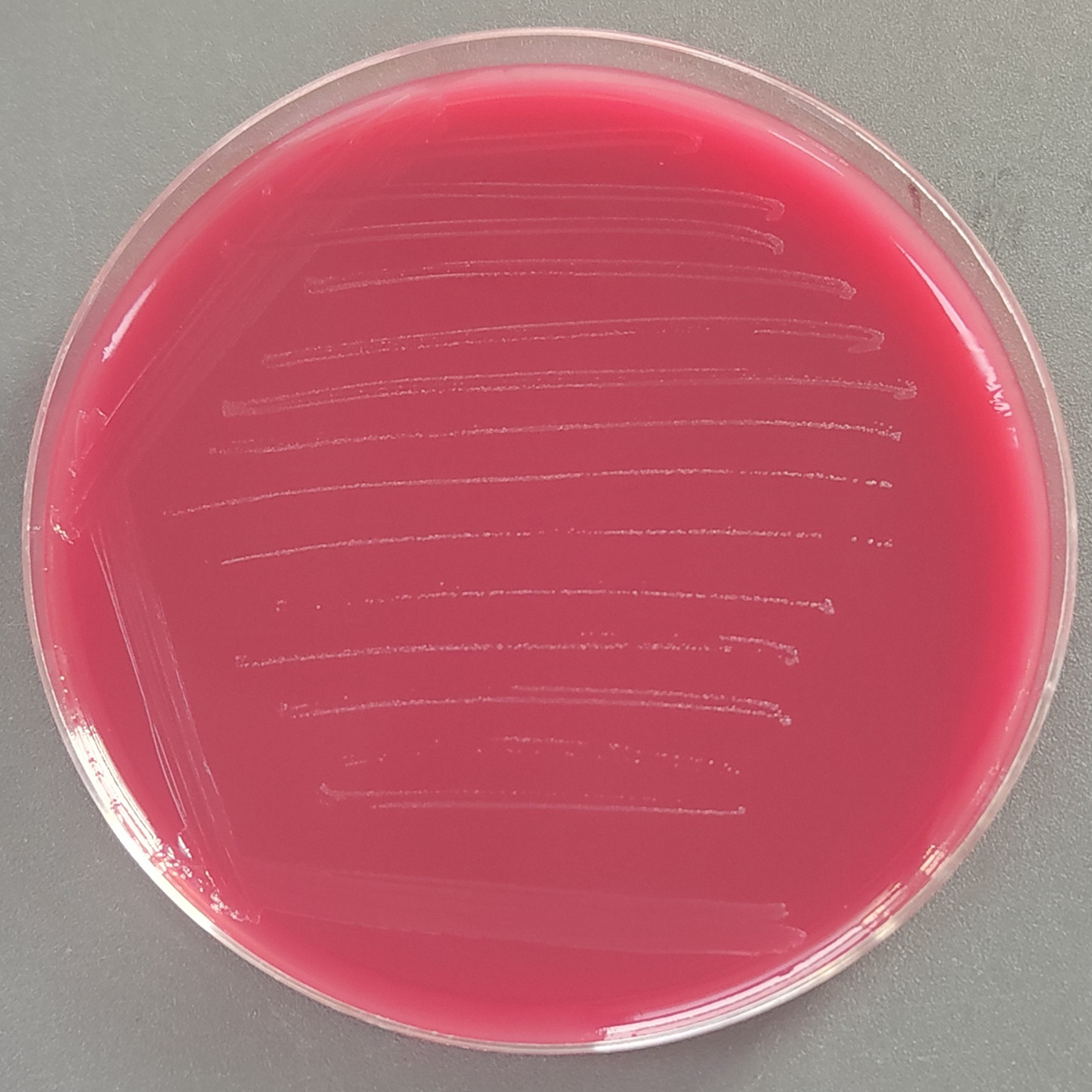 Microcystis-BNCC