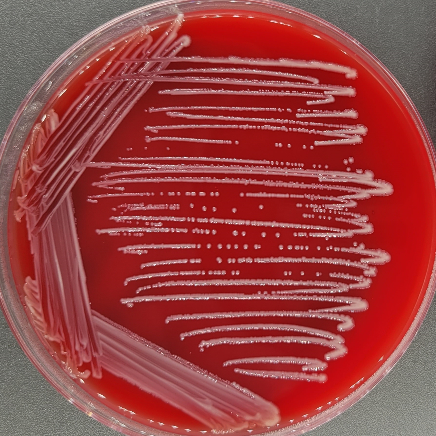 Acinetobacter baumannii-BNCC