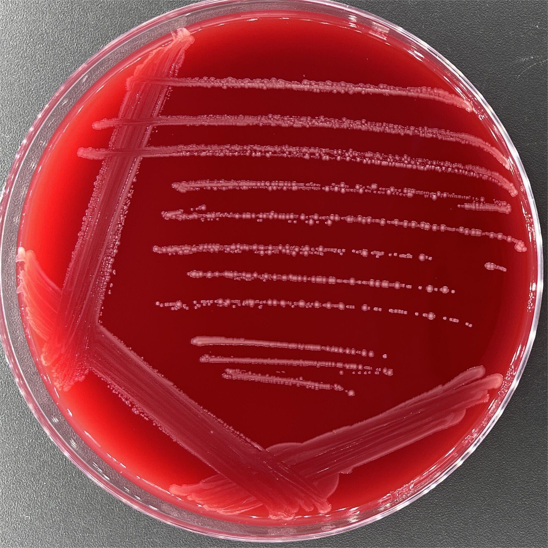 Wastewater Acinetobacter-BNCC