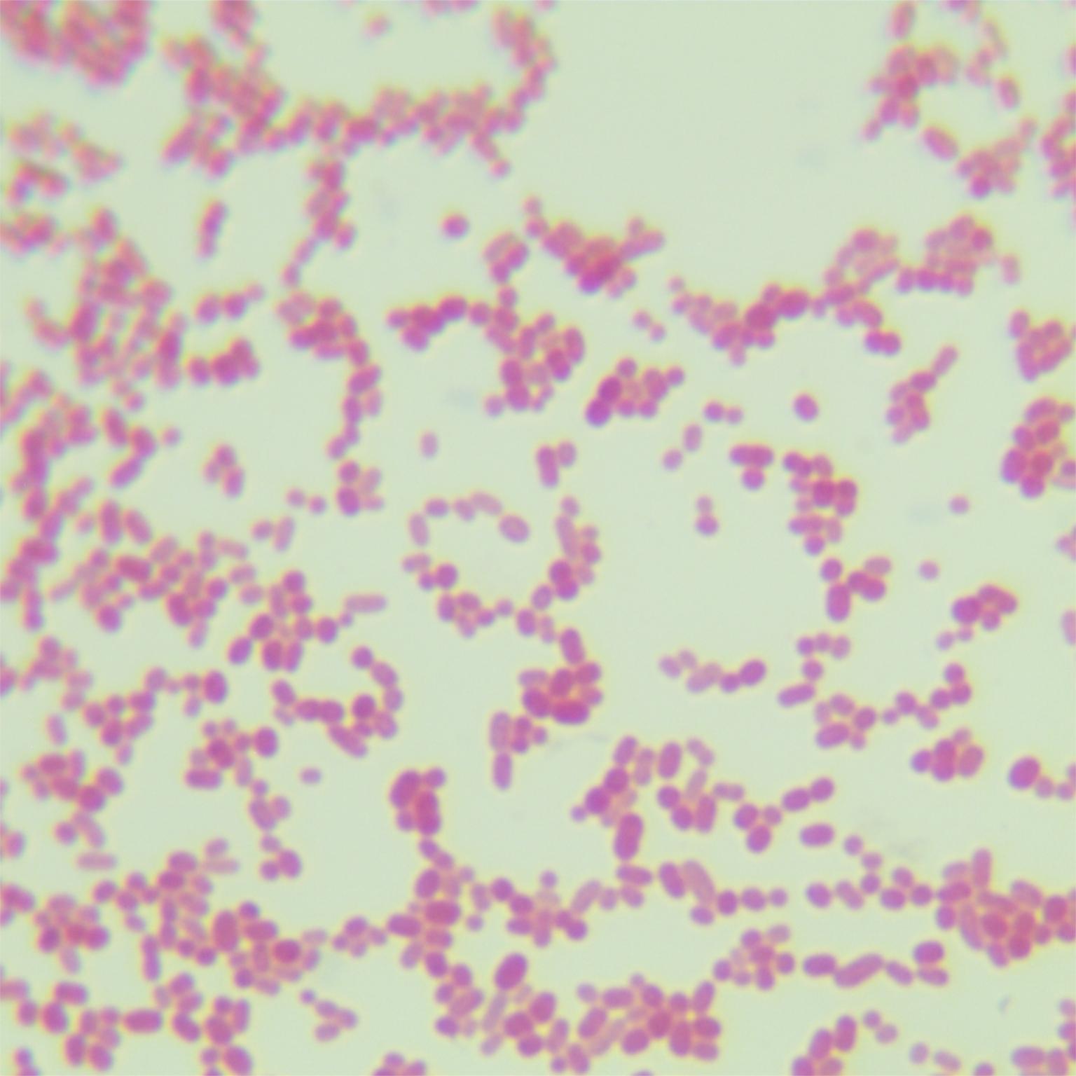 Wastewater Acinetobacter-BNCC
